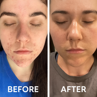 Tallow and Manuka Honey Face Balm